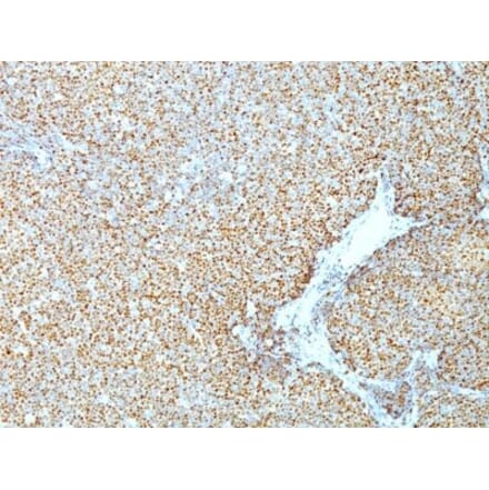 Immunohistochemistry (formalin-fixed, paraffin-embedded) - Anti-Cyclin D1 Antibody [CCND1/809] (CF®740) (A352883) - Antibodies.com