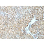 Immunohistochemistry (formalin-fixed, paraffin-embedded) - Anti-Cyclin D1 Antibody [CCND1/809] (CF®488A) (A352884) - Antibodies.com