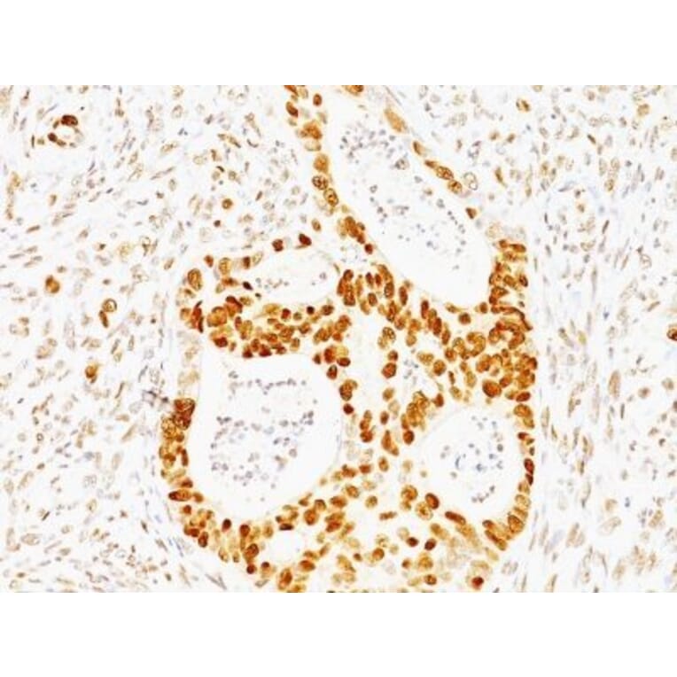 Immunohistochemistry (formalin-fixed, paraffin-embedded) - Anti-p53 Antibody [TRP/817] (Biotin) (A352902) - Antibodies.com