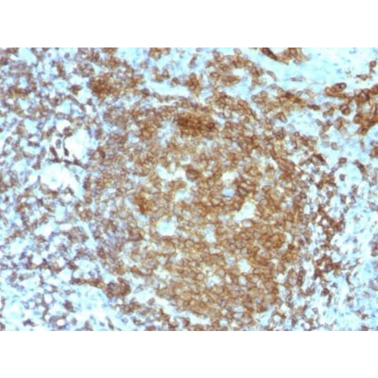 Immunohistochemistry (formalin-fixed, paraffin-embedded) - Anti-CD45RA Antibody [PTPRC/818] (CF®640R) (A352904) - Antibodies.com