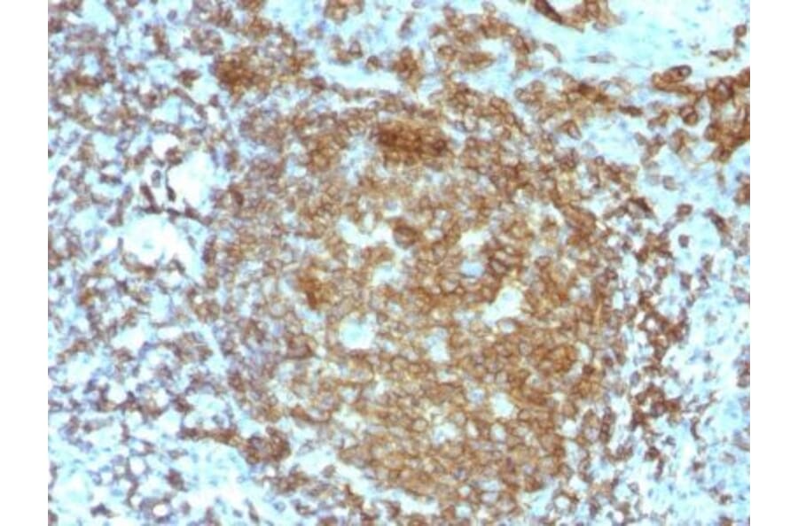 Immunohistochemistry (formalin-fixed, paraffin-embedded) - Anti-CD45RA Antibody [PTPRC/818] (CF®647) (A352905) - Antibodies.com