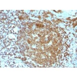 Immunohistochemistry (formalin-fixed, paraffin-embedded) - Anti-CD45RA Antibody [PTPRC/818] (CF®568) (A352906) - Antibodies.com