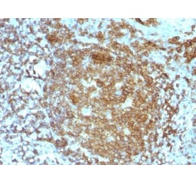 Immunohistochemistry (formalin-fixed, paraffin-embedded) - Anti-CD45RA Antibody [PTPRC/818] (CF®594) (A352909) - Antibodies.com