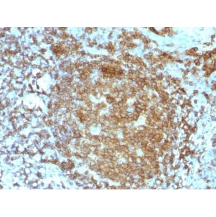 Immunohistochemistry (formalin-fixed, paraffin-embedded) - Anti-CD45RA Antibody [PTPRC/818] (Biotin) (A352910) - Antibodies.com