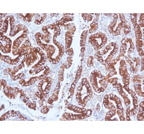 Immunohistochemistry (formalin-fixed, paraffin-embedded) - Anti-MUC5AC Antibody [CLH2] (CF®647) (A352929) - Antibodies.com