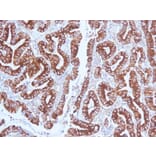 Immunohistochemistry (formalin-fixed, paraffin-embedded) - Anti-MUC5AC Antibody [CLH2] (CF®740) (A352931) - Antibodies.com