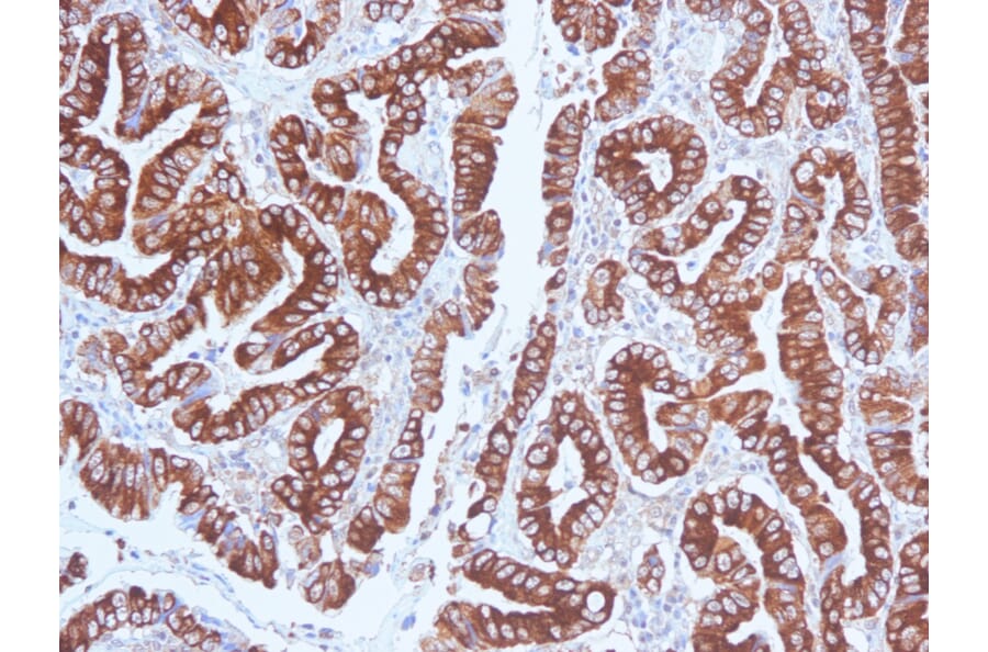 Immunohistochemistry (formalin-fixed, paraffin-embedded) - Anti-MUC5AC Antibody [CLH2] (CF®594) (A352933) - Antibodies.com