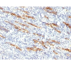Immunohistochemistry (formalin-fixed, paraffin-embedded) - Anti-CD34 Antibody [QBEnd/10 + HPCA1/763] (CF®405S) (A352936) - Antibodies.com