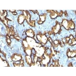 Immunohistochemistry (formalin-fixed, paraffin-embedded) - Anti-CD34 Antibody [QBEnd/10 + HPCA1/763] (CF®405S) (A352936) - Antibodies.com