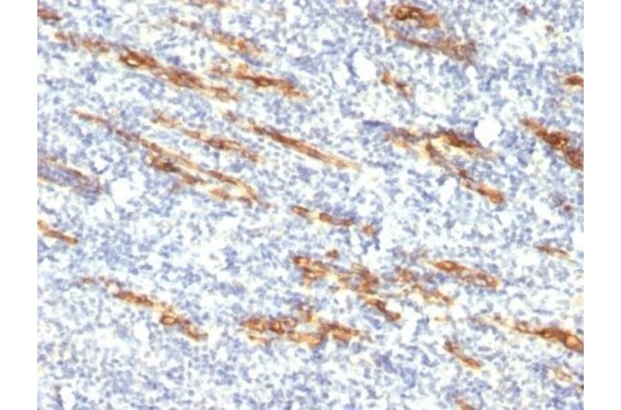 Immunohistochemistry (formalin-fixed, paraffin-embedded) - Anti-CD34 Antibody [QBEnd/10 + HPCA1/763] (CF®640R) (A352938) - Antibodies.com