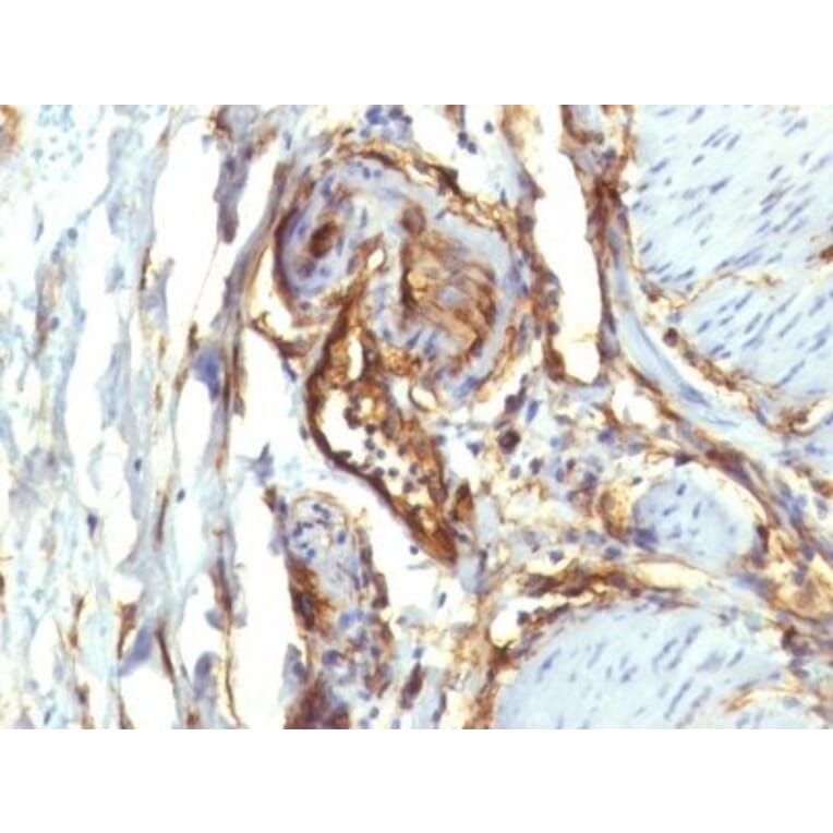 Immunohistochemistry (formalin-fixed, paraffin-embedded) - Anti-CD34 Antibody [QBEnd/10 + HPCA1/763] (CF®640R) (A352938) - Antibodies.com