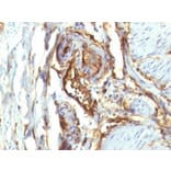 Immunohistochemistry (formalin-fixed, paraffin-embedded) - Anti-CD34 Antibody [QBEnd/10 + HPCA1/763] (CF®555) (A352940) - Antibodies.com