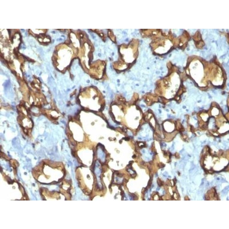 Immunohistochemistry (formalin-fixed, paraffin-embedded) - Anti-CD34 Antibody [QBEnd/10 + HPCA1/763] (CF®568) (A352941) - Antibodies.com