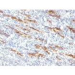 Immunohistochemistry (formalin-fixed, paraffin-embedded) - Anti-CD34 Antibody [QBEnd/10 + HPCA1/763] (CF®740) (A352942) - Antibodies.com