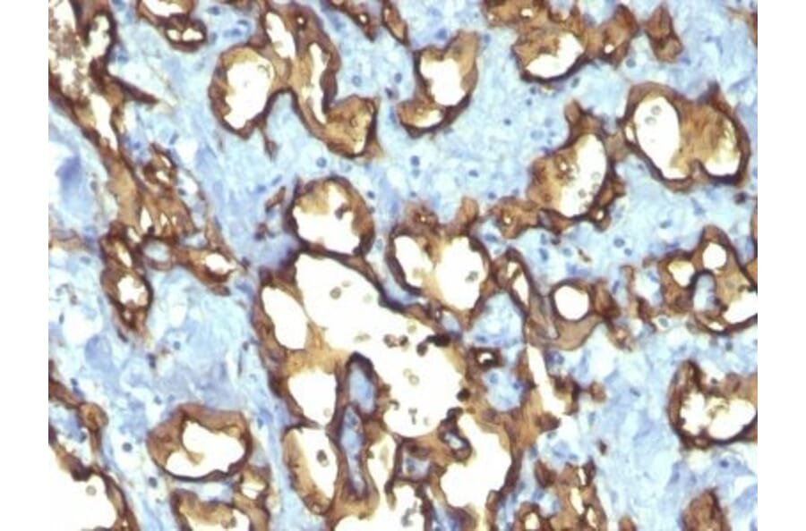 Immunohistochemistry (formalin-fixed, paraffin-embedded) - Anti-CD34 Antibody [QBEnd/10 + HPCA1/763] (CF®488A) (A352943) - Antibodies.com