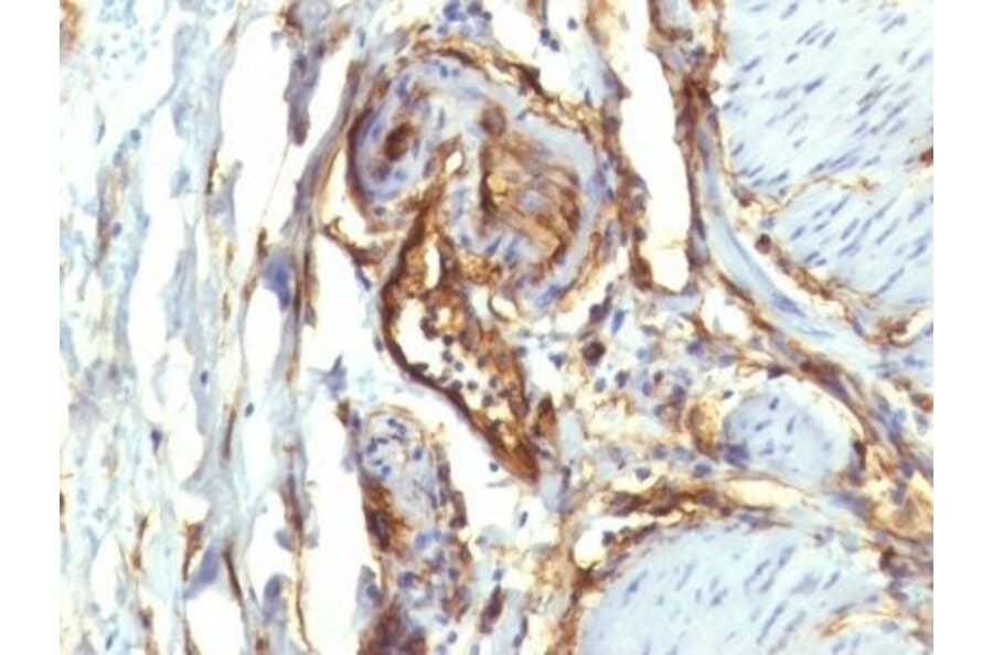 Immunohistochemistry (formalin-fixed, paraffin-embedded) - Anti-CD34 Antibody [QBEnd/10 + HPCA1/763] (CF®488A) (A352943) - Antibodies.com