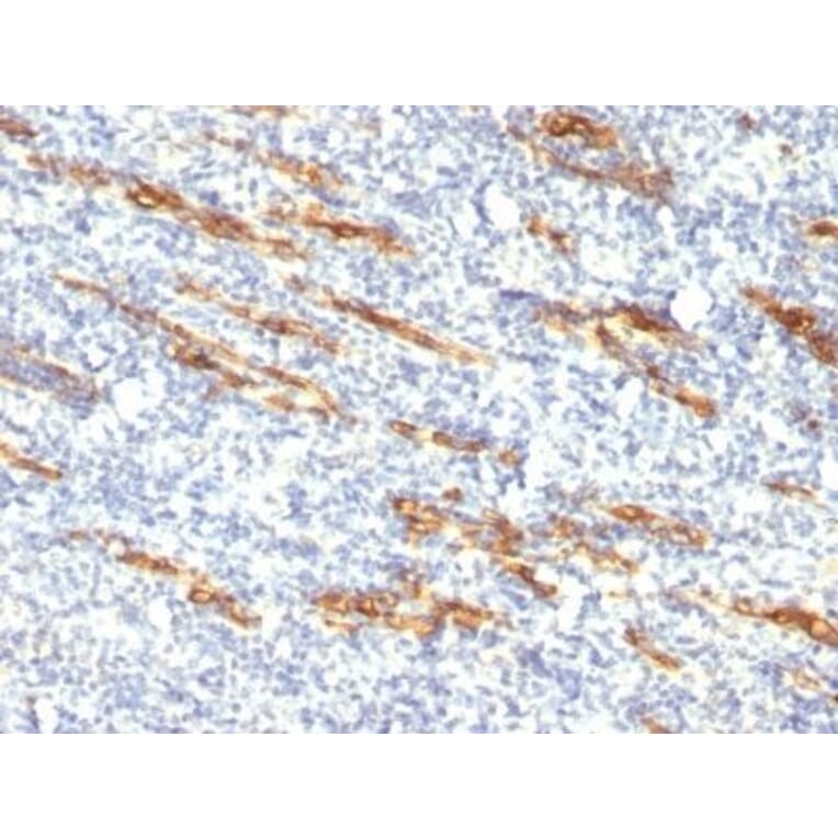 Immunohistochemistry (formalin-fixed, paraffin-embedded) - Anti-CD34 Antibody [QBEnd/10 + HPCA1/763] (CF®594) (A352944) - Antibodies.com