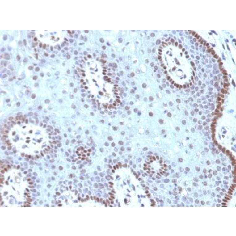 Immunohistochemistry (formalin-fixed, paraffin-embedded) - Anti-c-Myc Antibody [MYC909] (CF®640R) (A352947) - Antibodies.com