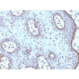 Immunohistochemistry (formalin-fixed, paraffin-embedded) - Anti-c-Myc Antibody [MYC909] (CF®568) (A352949) - Antibodies.com