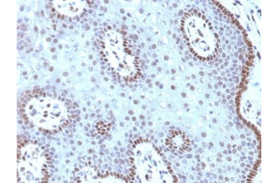 Immunohistochemistry (formalin-fixed, paraffin-embedded) - Anti-c-Myc Antibody [MYC909] (CF®488A) (A352951) - Antibodies.com