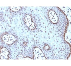 Immunohistochemistry (formalin-fixed, paraffin-embedded) - Anti-c-Myc Antibody [MYC909] (CF®594) (A352952) - Antibodies.com