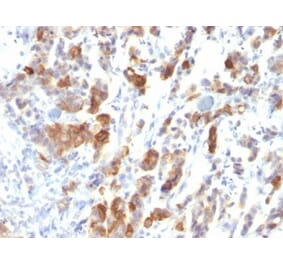 Immunohistochemistry (formalin-fixed, paraffin-embedded) - Anti-MUC5AC Antibody [MUC5AC/917] (CF®405S) (A352954) - Antibodies.com