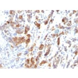Immunohistochemistry (formalin-fixed, paraffin-embedded) - Anti-MUC5AC Antibody [MUC5AC/917] (CF®647) (A352956) - Antibodies.com
