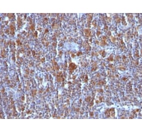 Immunohistochemistry (formalin-fixed, paraffin-embedded) - Anti-Bax Antibody [Bax/962] (CF®640R) (A352987) - Antibodies.com
