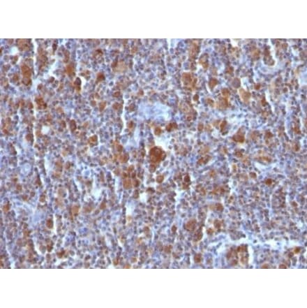 Immunohistochemistry (formalin-fixed, paraffin-embedded) - Anti-Bax Antibody [Bax/962] (CF®640R) (A352987) - Antibodies.com