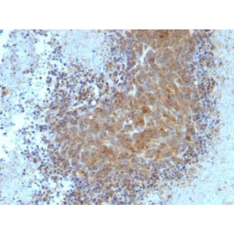 Immunohistochemistry (formalin-fixed, paraffin-embedded) - Anti-Bax Antibody [Bax/962] (CF®647) (A352988) - Antibodies.com