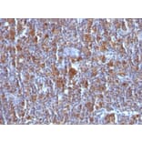 Immunohistochemistry (formalin-fixed, paraffin-embedded) - Anti-Bax Antibody [Bax/962] (CF®740) (A352990) - Antibodies.com