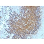 Immunohistochemistry (formalin-fixed, paraffin-embedded) - Anti-Bax Antibody [Bax/962] (CF®740) (A352990) - Antibodies.com