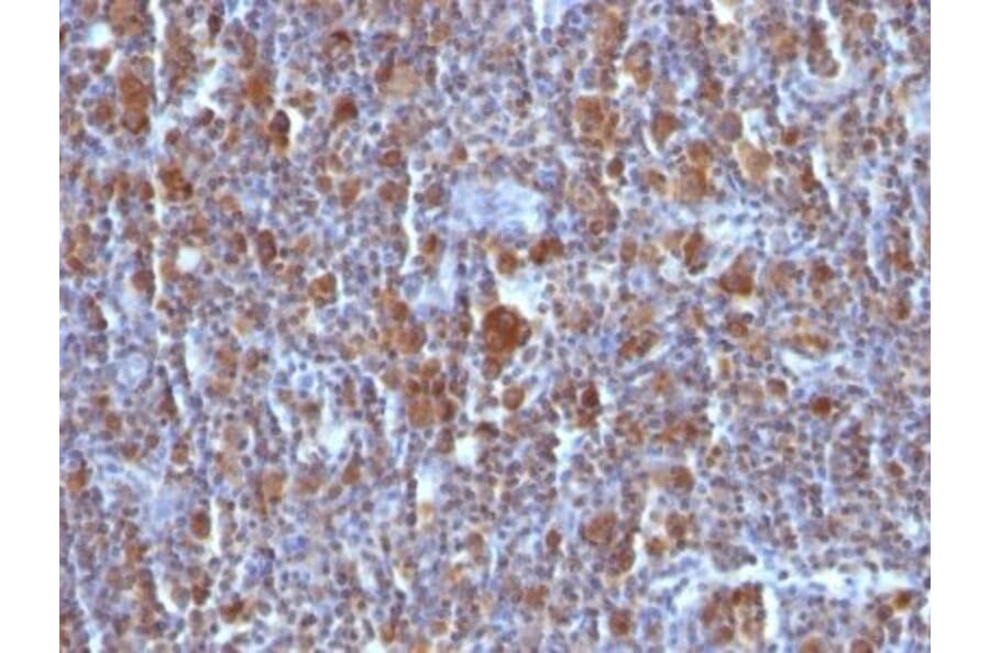 Immunohistochemistry (formalin-fixed, paraffin-embedded) - Anti-Bax Antibody [Bax/962] (CF®594) (A352992) - Antibodies.com