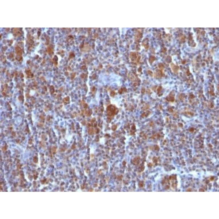 Immunohistochemistry (formalin-fixed, paraffin-embedded) - Anti-Bax Antibody [Bax/962] (CF®594) (A352992) - Antibodies.com