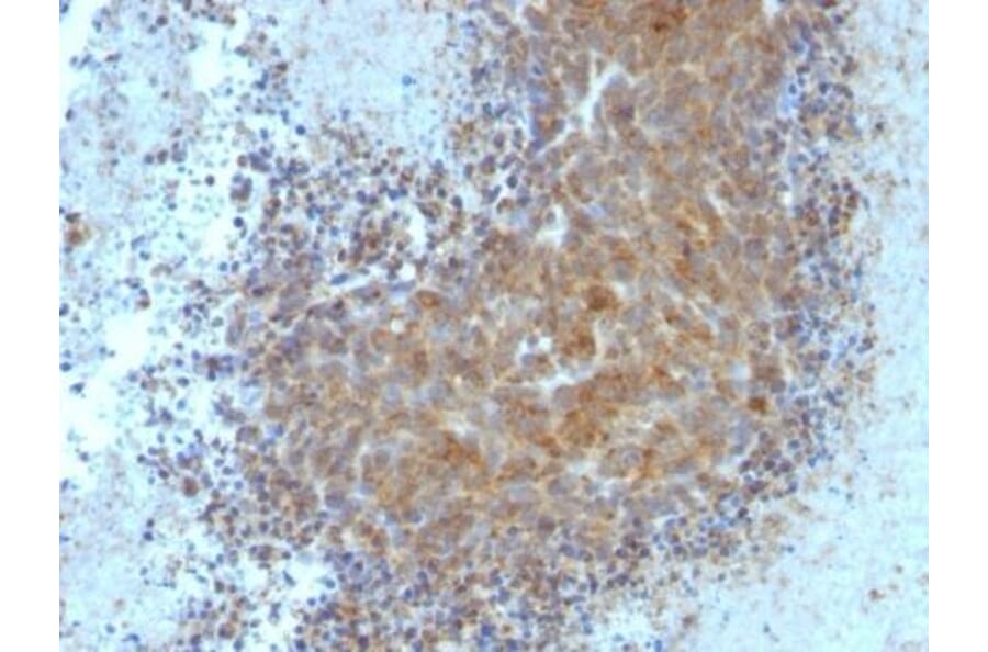 Immunohistochemistry (formalin-fixed, paraffin-embedded) - Anti-Bax Antibody [Bax/962] (Biotin) (A352993) - Antibodies.com