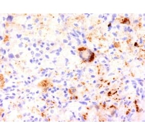 Immunohistochemistry (formalin-fixed, paraffin-embedded) - Anti-TNF alpha Antibody [J2D10] (Biotin) (A353018) - Antibodies.com