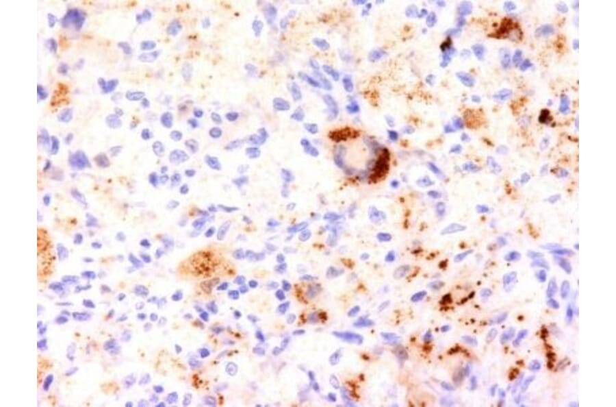 Immunohistochemistry (formalin-fixed, paraffin-embedded) - Anti-TNF alpha Antibody [J2D10] (Biotin) (A353018) - Antibodies.com