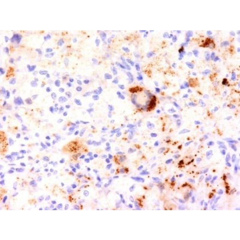 Immunohistochemistry (formalin-fixed, paraffin-embedded) - Anti-TNF alpha Antibody [J2D10] (Biotin) (A353018) - Antibodies.com