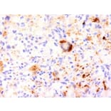 Immunohistochemistry (formalin-fixed, paraffin-embedded) - Anti-TNF alpha Antibody [J2D10] (Biotin) (A353018) - Antibodies.com