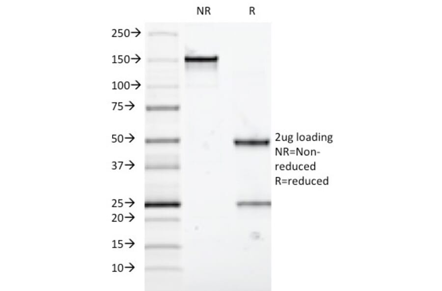SDS-PAGE - Anti-MUC5AC Antibody [58M1] (CF®405S) (A353019) - Antibodies.com