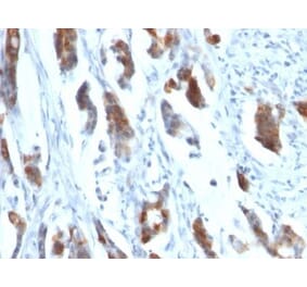 Immunohistochemistry (formalin-fixed, paraffin-embedded) - Anti-MUC5AC Antibody [58M1] (CF®640R) (A353020) - Antibodies.com