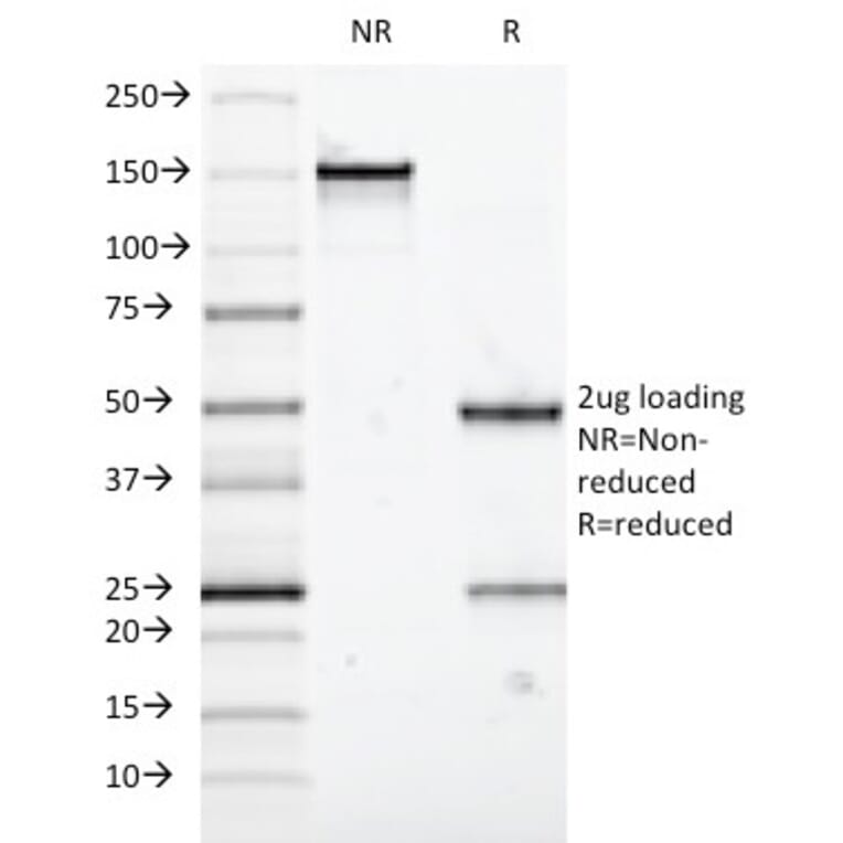 SDS-PAGE - Anti-MUC5AC Antibody [58M1] (CF®640R) (A353020) - Antibodies.com