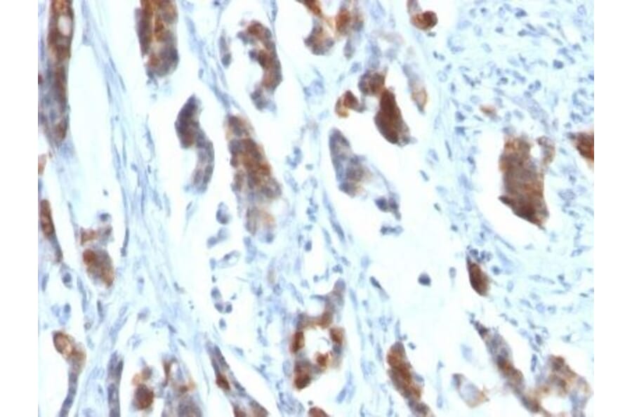 Immunohistochemistry (formalin-fixed, paraffin-embedded) - Anti-MUC5AC Antibody [58M1] (Biotin) (A353026) - Antibodies.com