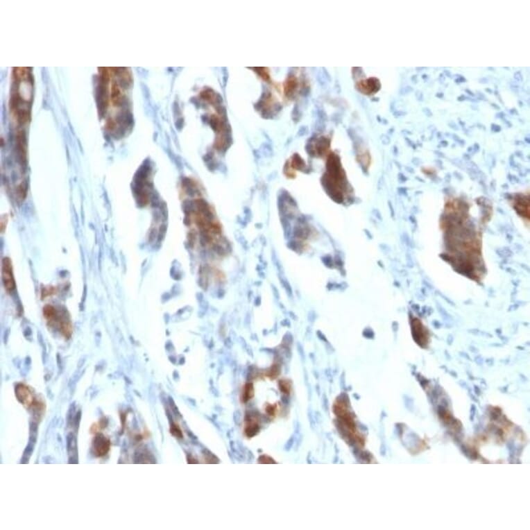 Immunohistochemistry (formalin-fixed, paraffin-embedded) - Anti-MUC5AC Antibody [58M1] (Biotin) (A353026) - Antibodies.com