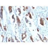 Immunohistochemistry (formalin-fixed, paraffin-embedded) - Anti-MUC5AC Antibody [58M1] (Biotin) (A353026) - Antibodies.com