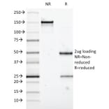 SDS-PAGE - Anti-MUC5AC Antibody [58M1] (Biotin) (A353026) - Antibodies.com