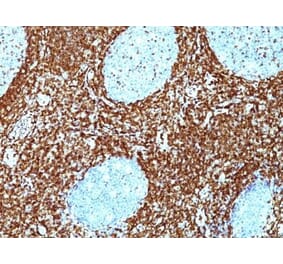 Immunohistochemistry (formalin-fixed, paraffin-embedded) - Anti-Bcl-2 Antibody [BCL2/782 + BCL2/796] (CF®405S) (A353043) - Antibodies.com