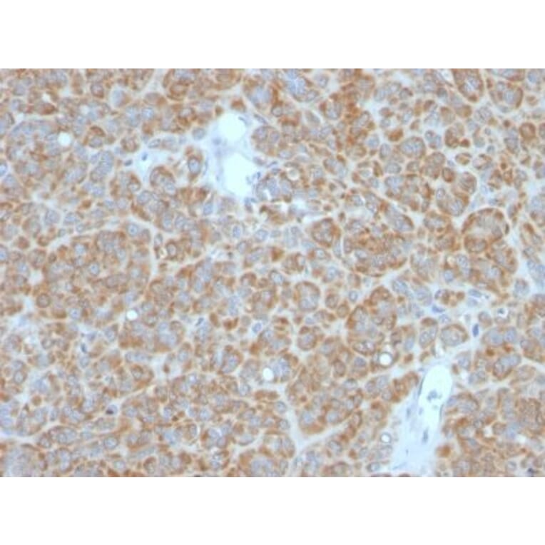 Immunohistochemistry (formalin-fixed, paraffin-embedded) - Anti-Bcl-2 Antibody [BCL2/782 + BCL2/796] (CF®405S) (A353043) - Antibodies.com