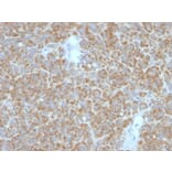 Immunohistochemistry (formalin-fixed, paraffin-embedded) - Anti-Bcl-2 Antibody [BCL2/782 + BCL2/796] (CF®640R) (A353044) - Antibodies.com