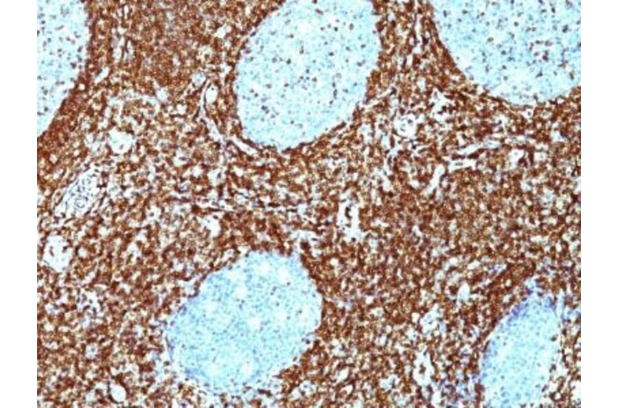 Immunohistochemistry (formalin-fixed, paraffin-embedded) - Anti-Bcl-2 Antibody [BCL2/782 + BCL2/796] (CF®488A) (A353048) - Antibodies.com